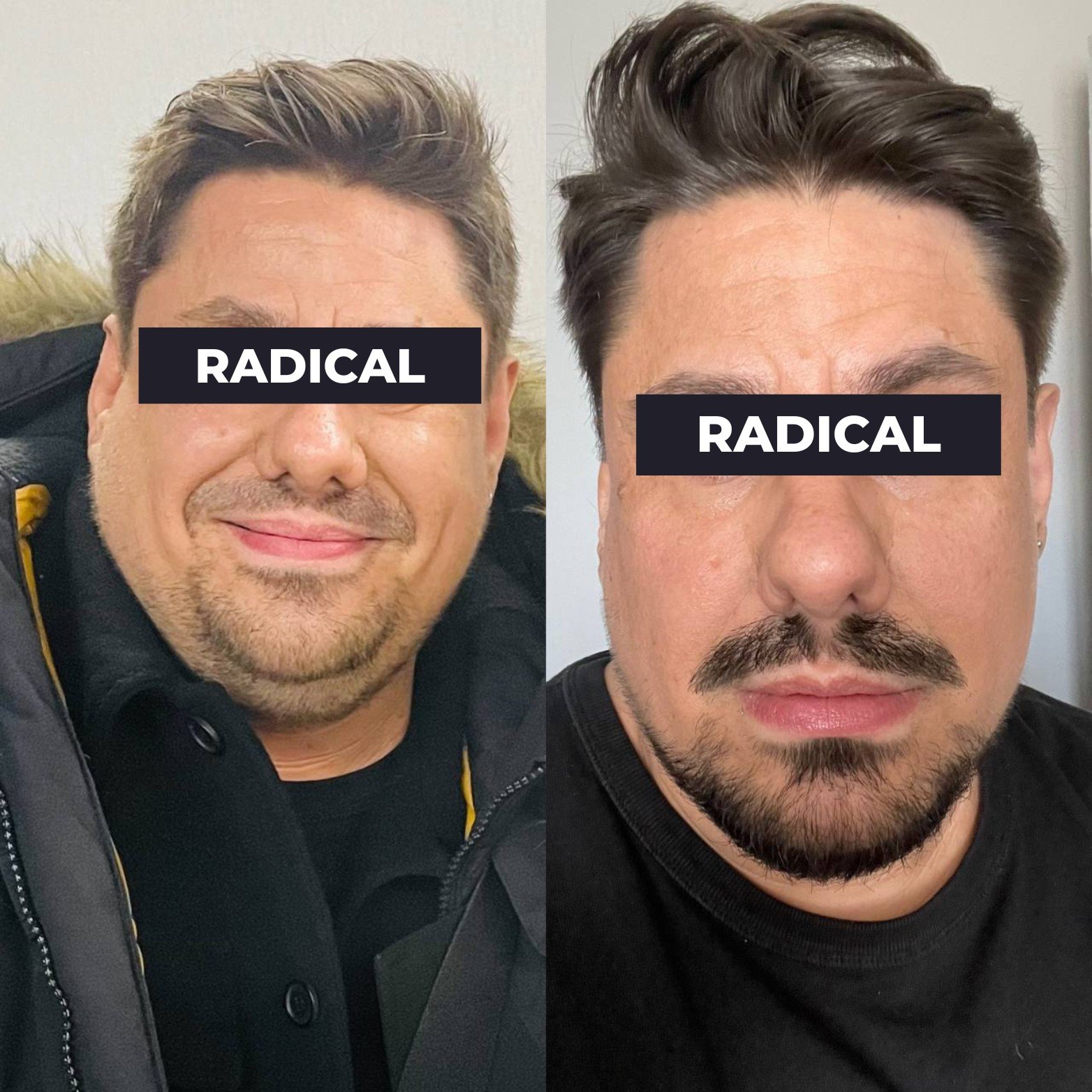 Transformation visage avant après